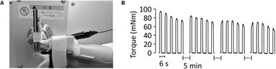 Electrical Stimulation Prevents Preferential Skeletal Muscle Myosin Loss in Steroid-Denervation Rats